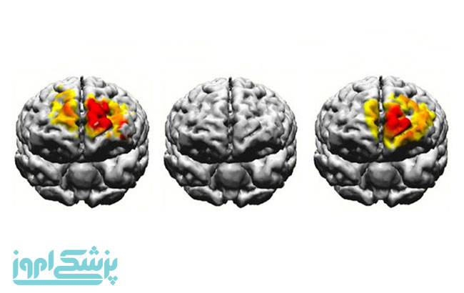 علل زوالعقل